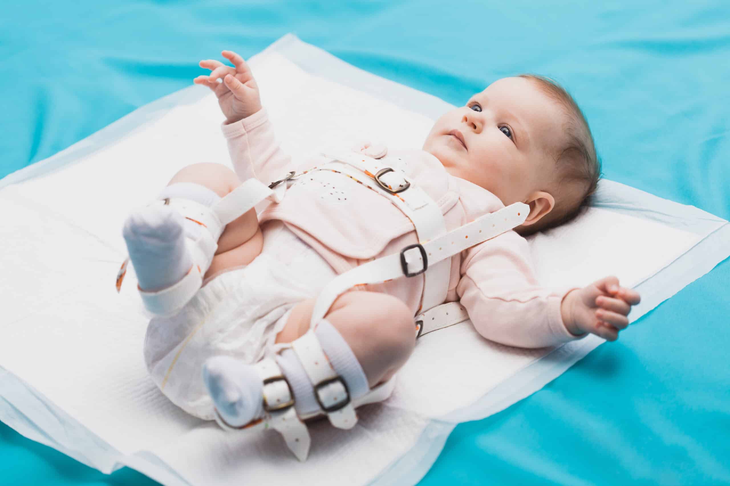 Babies in Hip Braces Western Kids Health Academy